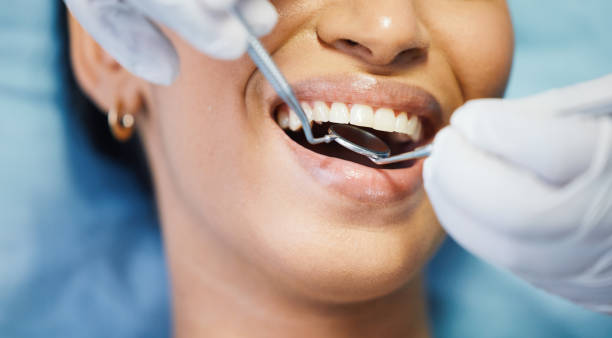 Best Emergency Dental Care for Broken or Chipped Teeth in Little Falls, MN