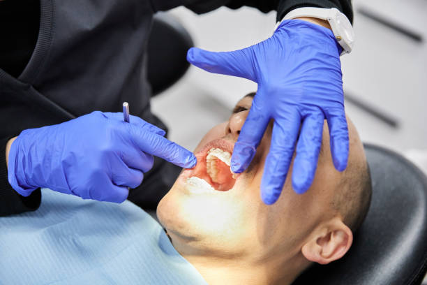 Best Emergency Dental Care for Broken or Chipped Teeth in Little Falls, MN