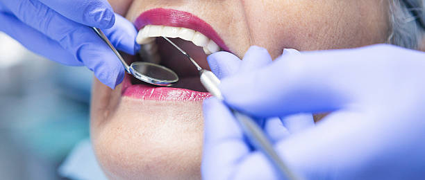 Best Emergency Treatment for Dental Infections or Abscesses in Little Falls, MN